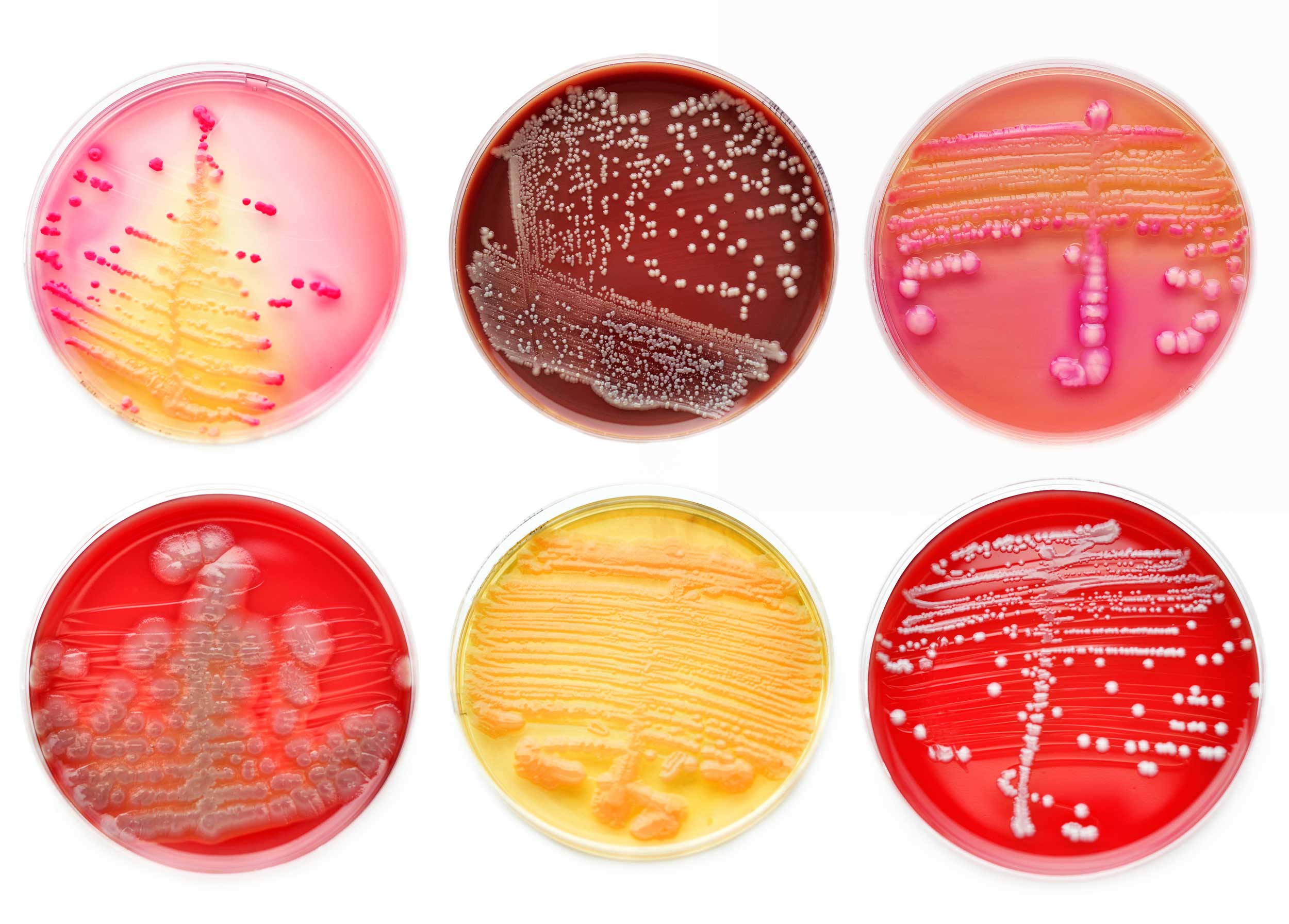 various Petri dish